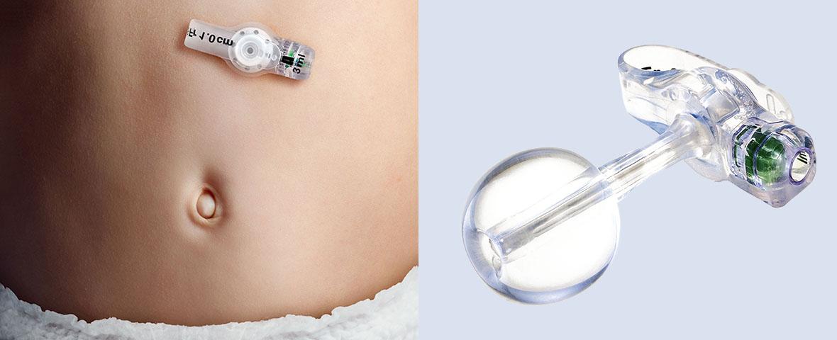 Belly Button