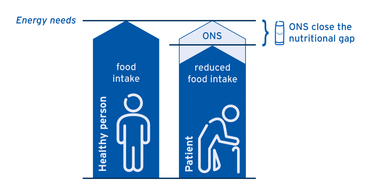 ONS